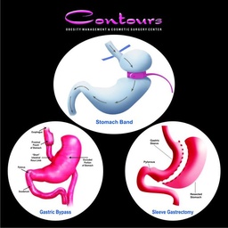 Contours - Weight Loss Obesity Bariatric & Cosmetic Surgery Centre Pakistan