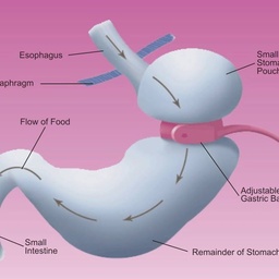 Contours - Weight Loss Obesity Bariatric & Cosmetic Surgery Centre Pakistan