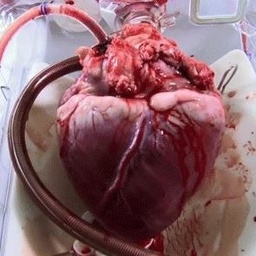 Hearts Health