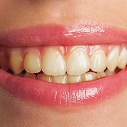 Dental Works