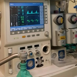 Anaesthesia