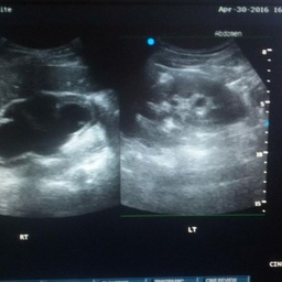 Medinix ultrasound