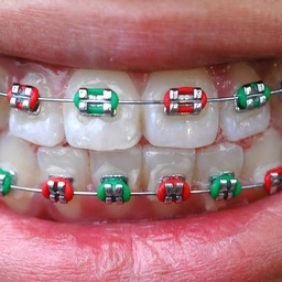 Dr.Sukhia Dental Surgery & Orthodontics, 1st Floor, Karachi