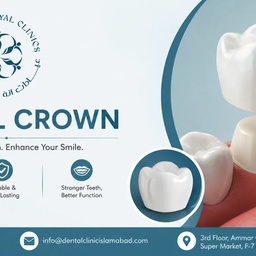 Dental Clinic Islamabad - Dr Usama Hayat | Teeth Aligners | Veneers | Dental Implants | Jaw Surgery
