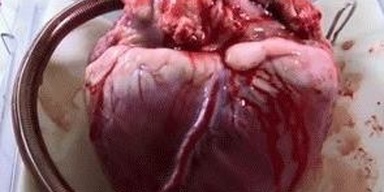 Hearts Health