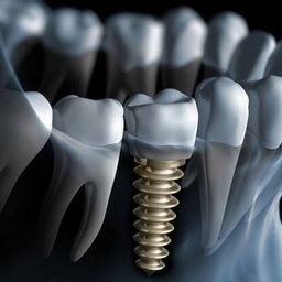 Dental Perfection