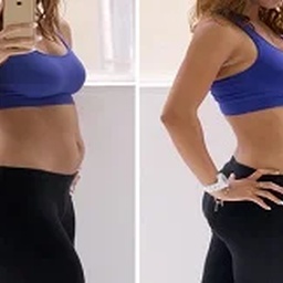 Laser Liposuction Treatment In Islamabad