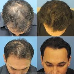 Plastic & Cosmetic Surgery Lahore