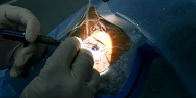 Ismat Eye Hospital