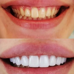 PAIN Free Dental Clinic 24 hours Dental emergency