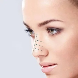 Nasim laser Skin Aesthetic
