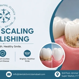 Dental Clinic Islamabad - Dr Usama Hayat | Teeth Aligners | Veneers | Dental Implants | Jaw Surgery
