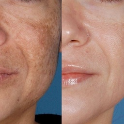 Plastic & Cosmetic Surgery Lahore