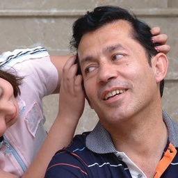 Modern hair transplant