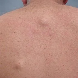 IpalClinic