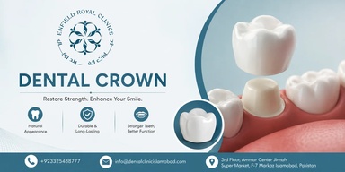 Dental Clinic Islamabad - Dr Usama Hayat | Teeth Aligners | Veneers | Dental Implants | Jaw Surgery