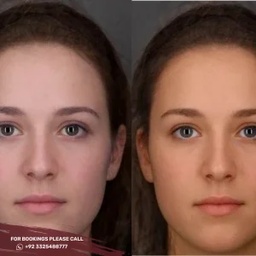 Skin Whitening in islamabad