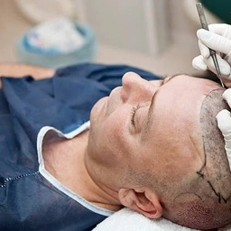 Cheap Hair Transplant Clinic Pakistan
