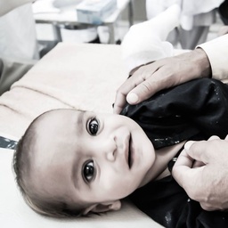 JPMC Clubfoot Clinic, Ponseti Research and Training Center