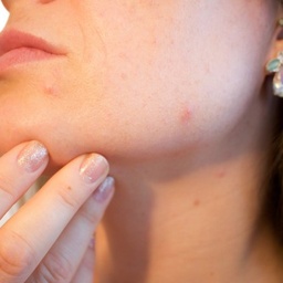 Skinfinity.pk