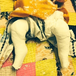 JPMC Clubfoot Clinic, Ponseti Research and Training Center